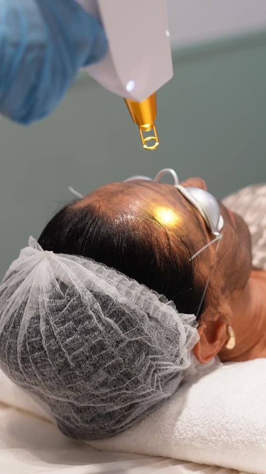 Aplicação de tratamento na All Clinique em Carcavelos